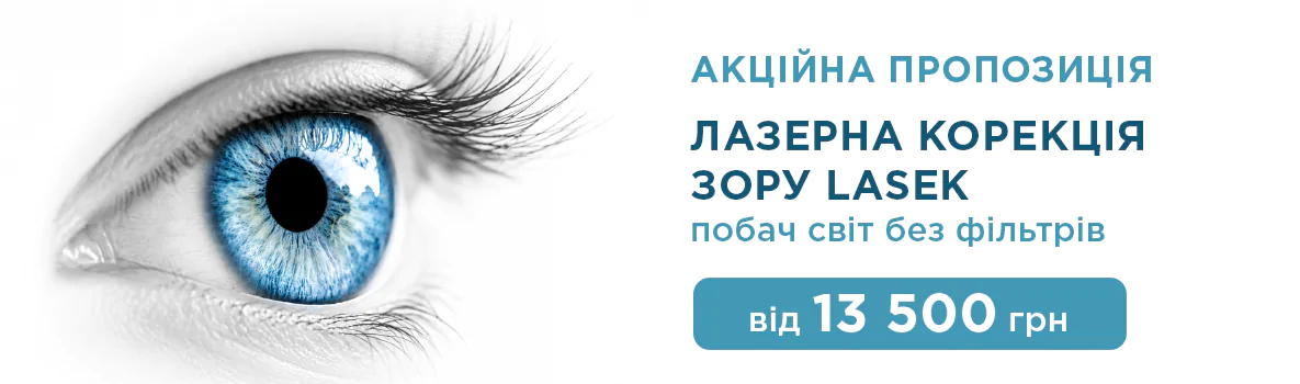 Лазерна корекція зору в Києві, фото 5